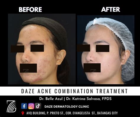 DAZE DERMATOLOGY CLINIC (@dazedermatologyclinic).